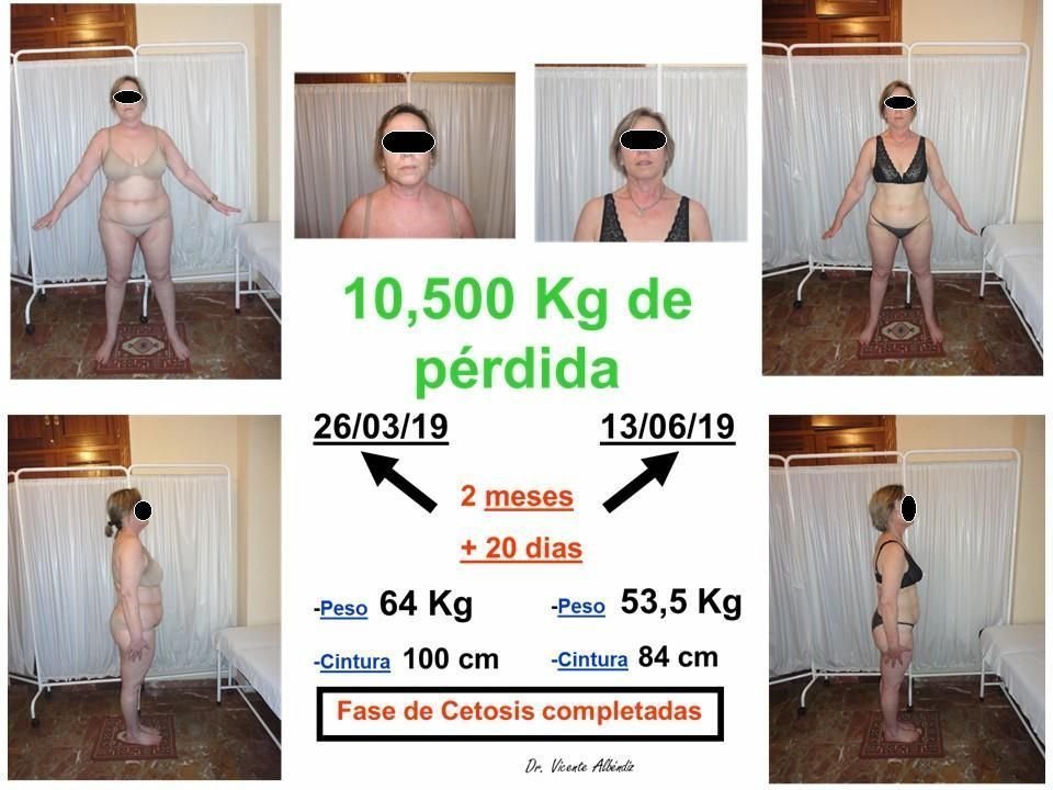 IsabelCortescetosisoculta