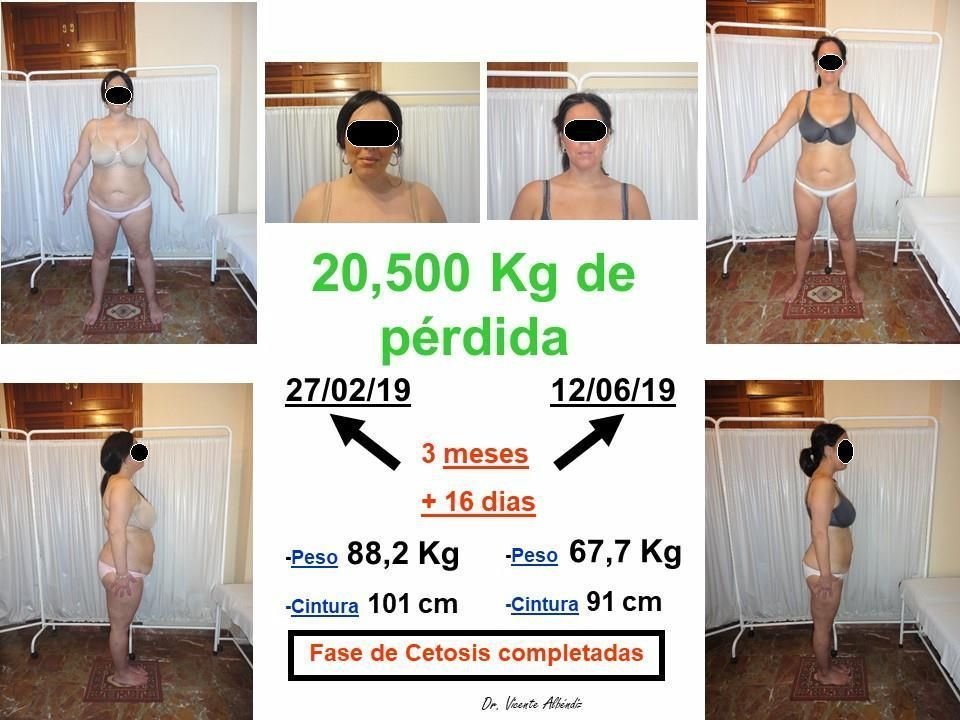 PatriciaAguileraBarcocetosisoculta