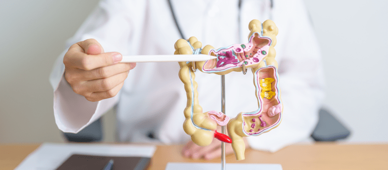 que-es-diverticulosis-diverticulitis-causas-sintomas